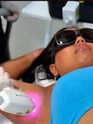 Sessão de depilação a laser